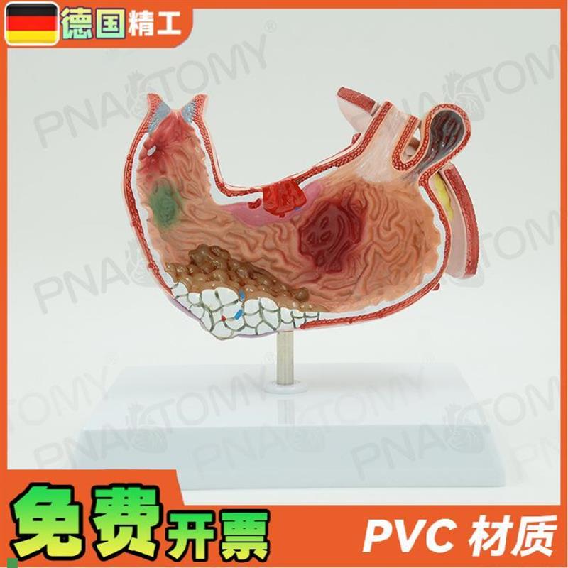 德国】人b体胃结构消化系统解剖模型病理展示标本医学内脏器官消