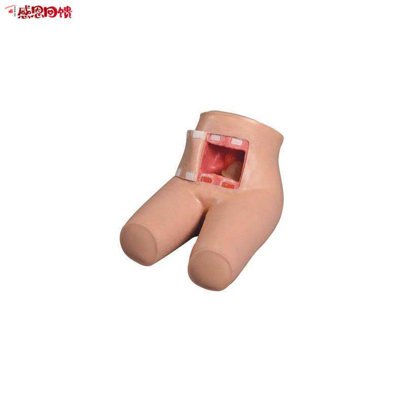 灌肠和辅助排A便训练模型灌肠排便模
