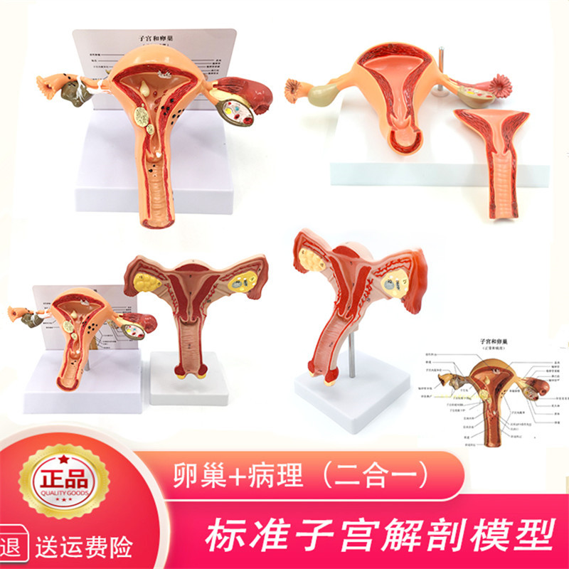 女性生殖子宫模型 卵巢病理变y化 骨盆盆腔矢状会阴盆底肌教学模