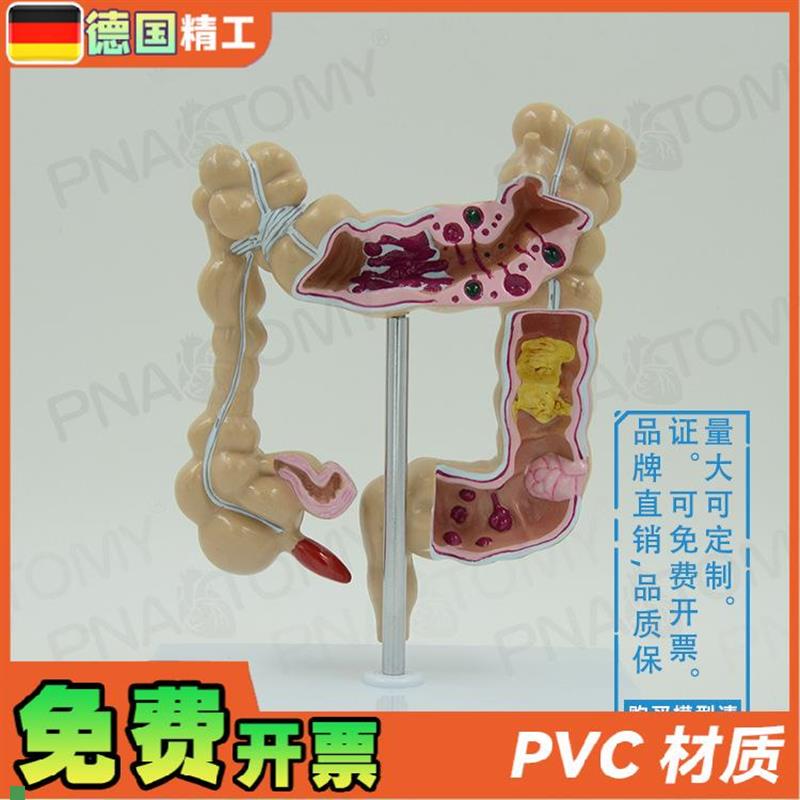 德国】仿真人体结肠大肠解剖模型肛肠科肠道肠胃Y消化系统教学