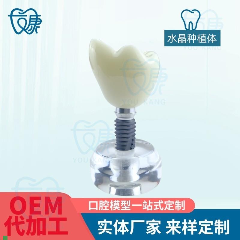 水晶种植体模型透明牙科模型教学医患沟通模型诊室摆Y件齿科材料