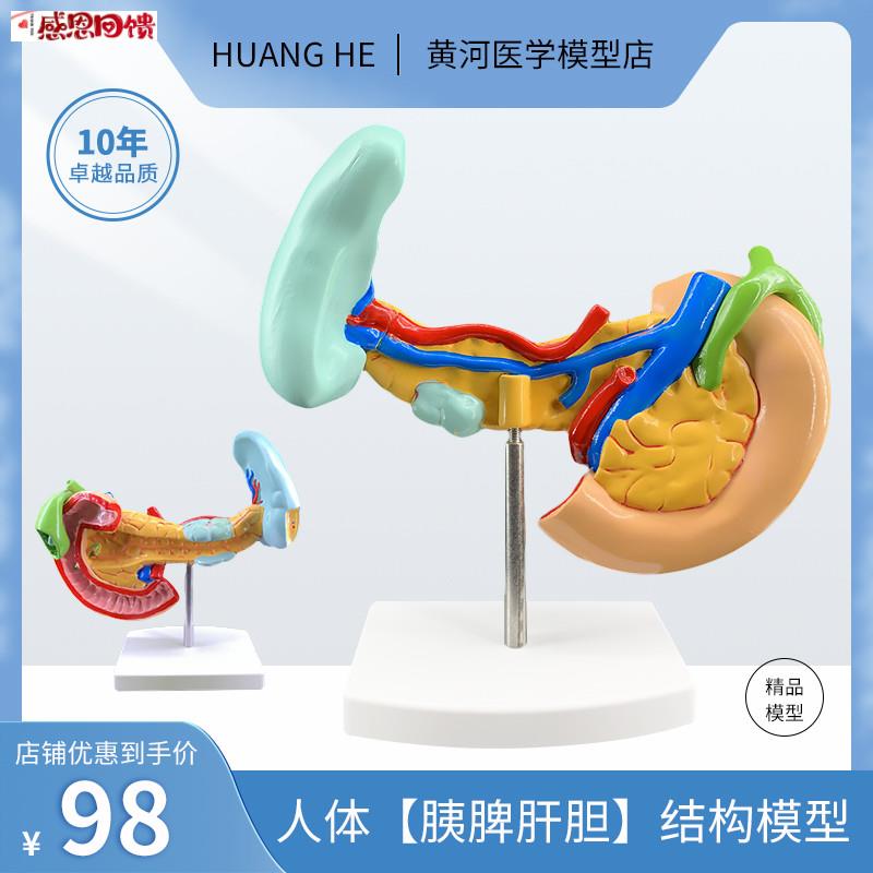 病变胰脾肝胆十二指肠模型病理标本胰w脾肝胆人体器官解剖教学模