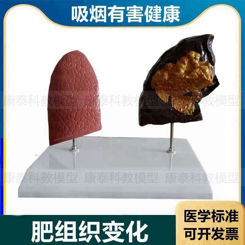 吸烟危害健康模型科普展示警示教育模具戒烟宣S传展览培训烟民内