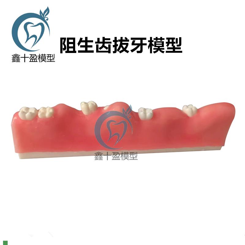 牙科阻生齿拔牙模型牙齿模型口腔教学仿真口腔护理牙医.诊所牙齿