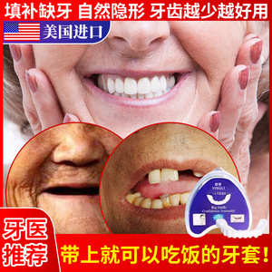 牙套吃饭神器老人没牙仿真假牙齿贴片男万能通用全瓷临时遮丑专用