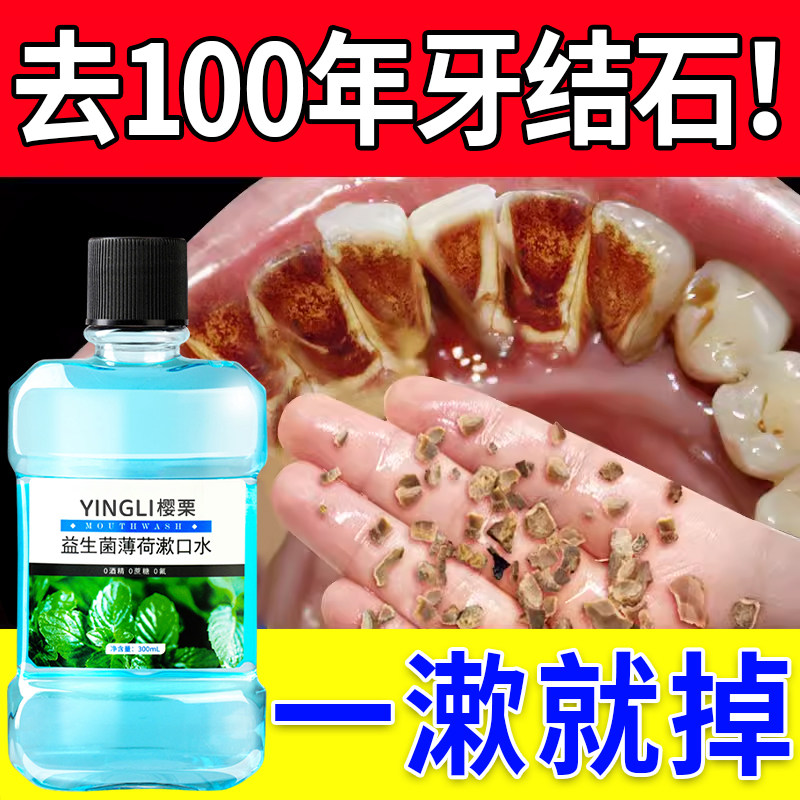 益生菌漱口水杀除口臭菌持久留香消遬炎抗簌涑去嗽牙结石溶解男生