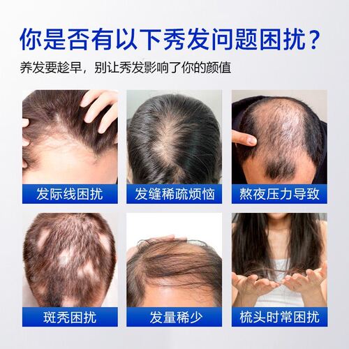 【加拿大原装进口】LFLF 根源赋活防脱洗发水 专研科学防脱 洗发