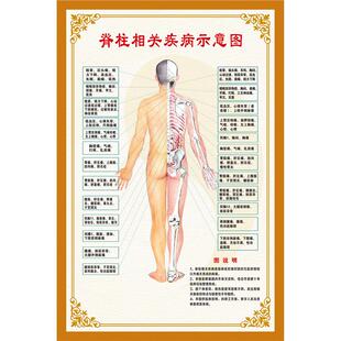 脊柱相关疾病的脊背触诊诊断示意图海报医学医院人体器官解剖挂图