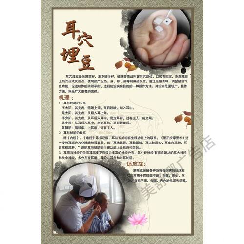 耳穴埋豆养生疗法好处功效适应症人群宣传广告贴纸装饰画挂图海报