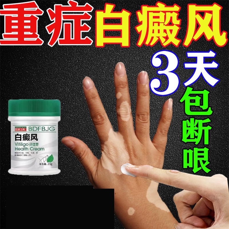 白殿风外用药膏黑色素生长补骨脂酊快速消白斑白癜疯风凤专用药膏