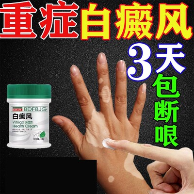 白殿风外用药膏黑色素生长补骨脂酊快速消白斑白癜疯风凤专用药膏