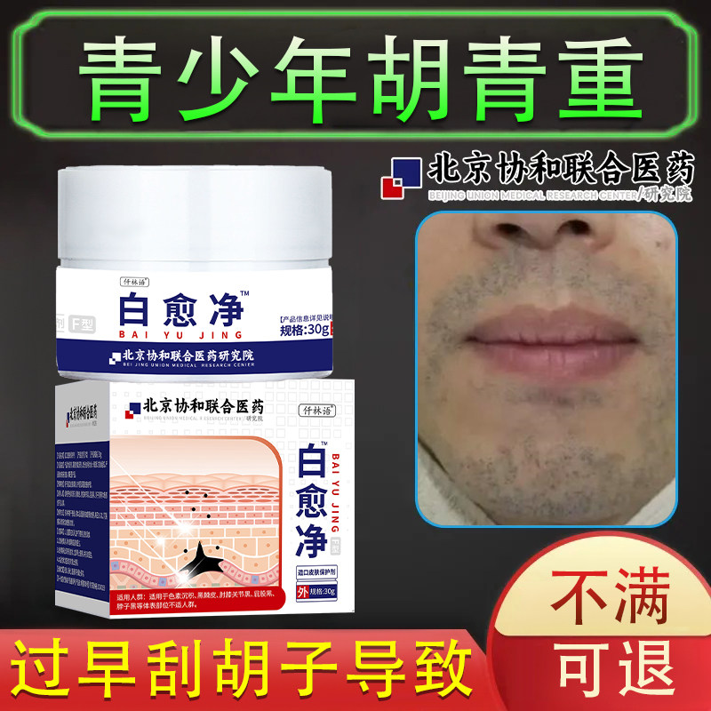 胡青重下巴黑男生显邋遢刮胡子太早胡根粗黑色素沉积毛孔粗大qo