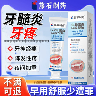 牙髓炎牙神经痛药房同售龋齿夜间牙疼痛可搭配专用牙膏漱口水