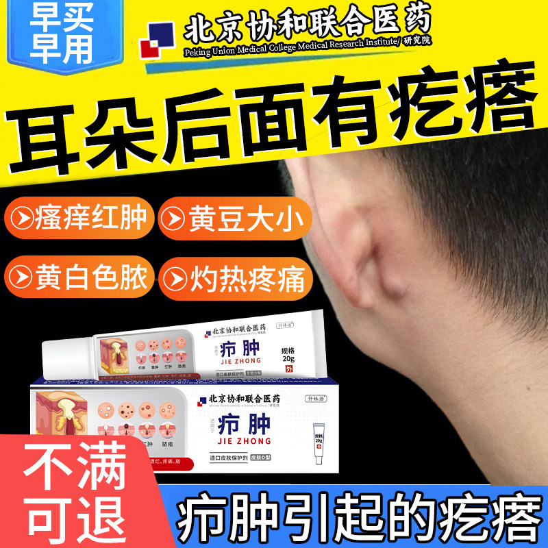 耳朵后面有疙瘩皮脂腺囊肿火疖子搭膏药贴耳朵后脓疱疼红肿硬块uc