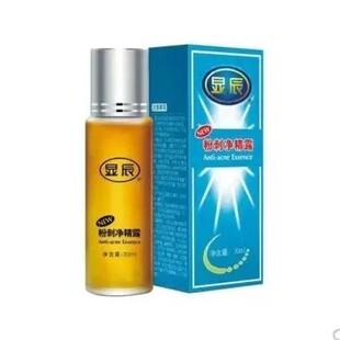 祛痘祛痘印显辰粉刺净精露,泽平老配方祛痘祛印控油男女祛痘印