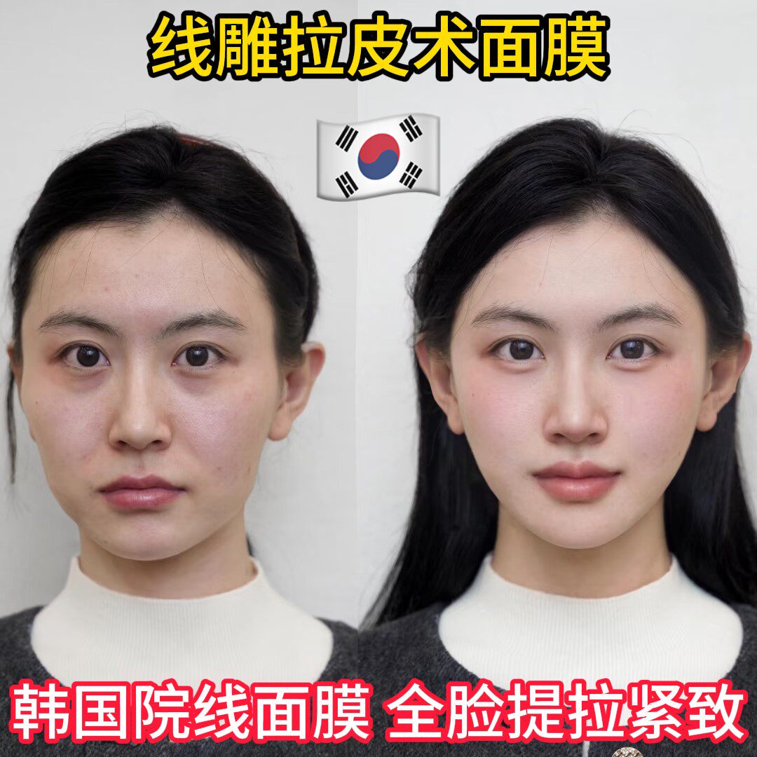 【韩国院线】线雕面膜 胶原蛋白抗皱 淡化法令纹提拉紧致小V脸女