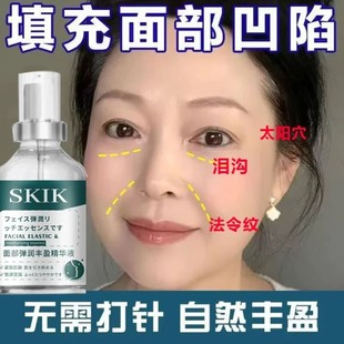 【日本技术】泪沟抚平丰盈额头太阳穴脸颊凹陷法令纹修复脸部神器