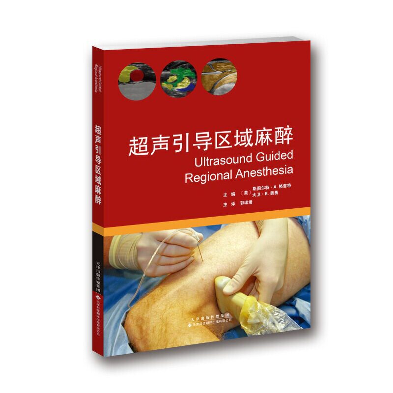 超声引导区域麻醉属于什么档次？
