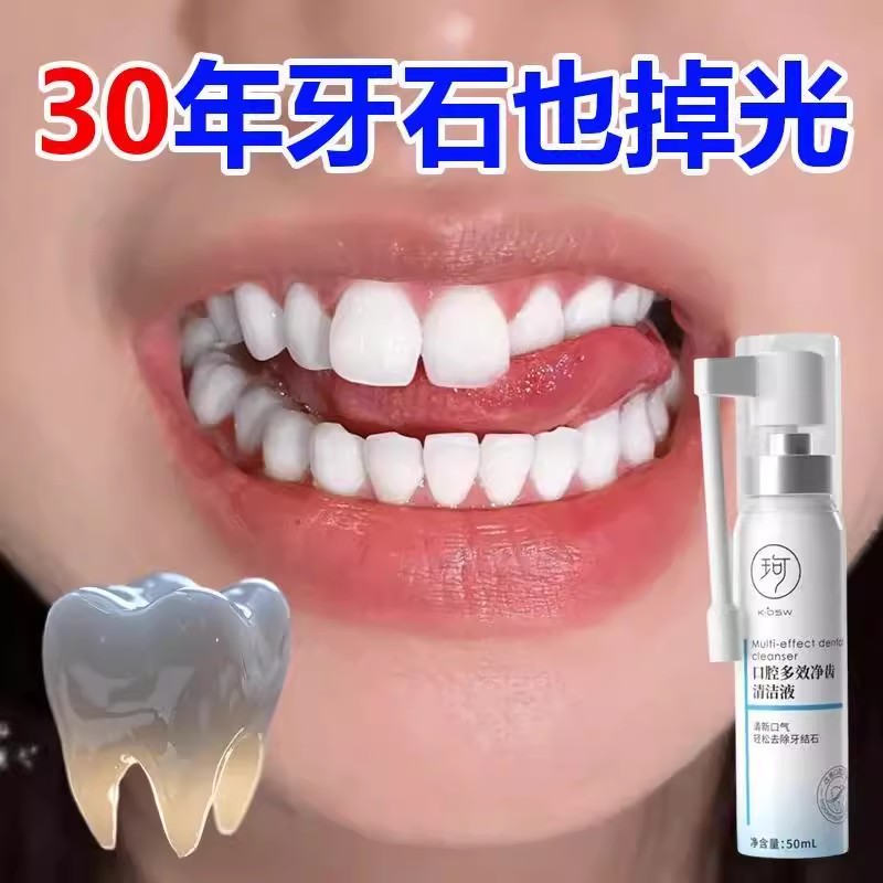 【谁还去洗牙】牙结石一喷就掉 持久清新口气 口腔多效净齿清洁液