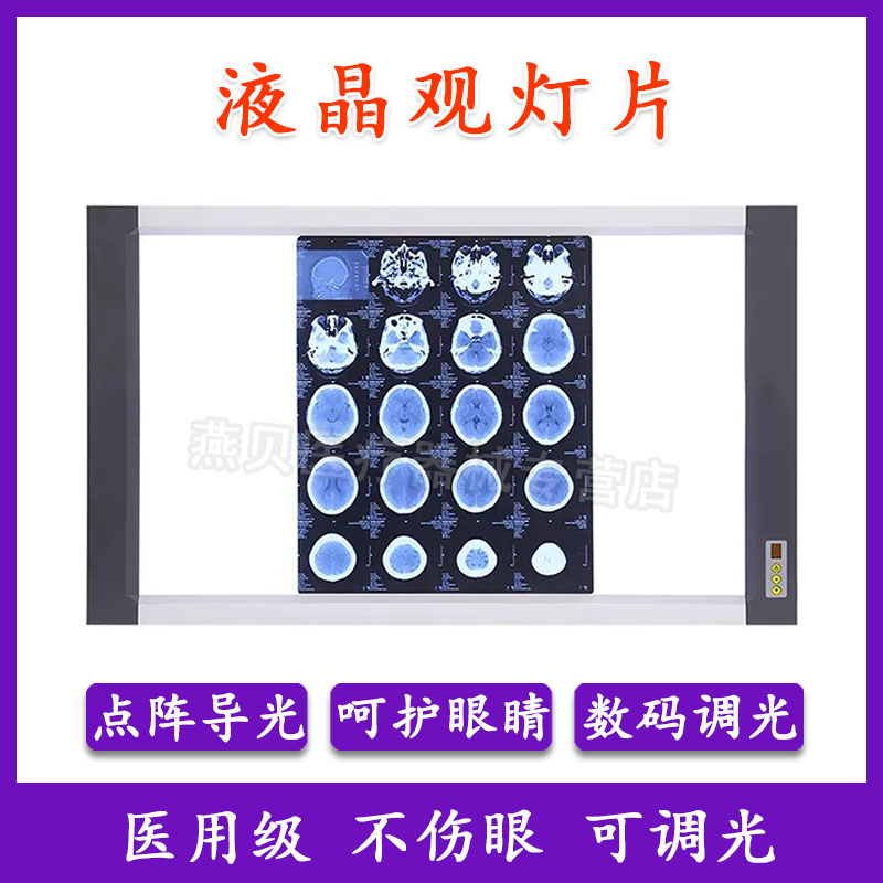 X光阅片灯CT核磁骨科医用观片灯