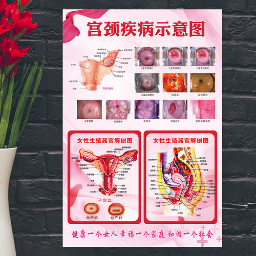 模糊包退女性生殖器系统解剖图