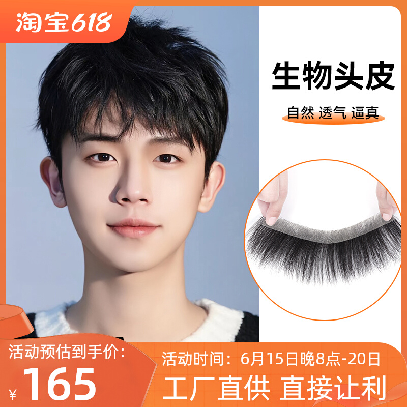 男士前额发际线假发贴全真发轻薄M型额头生物头皮隐形刘海片