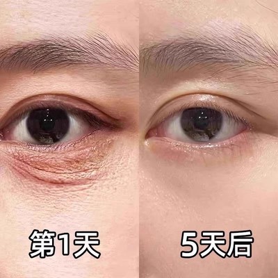 【屈臣氏推荐】再见眼角纹~淡化黑眼圈~收缩眼袋提拉眼部男女通用