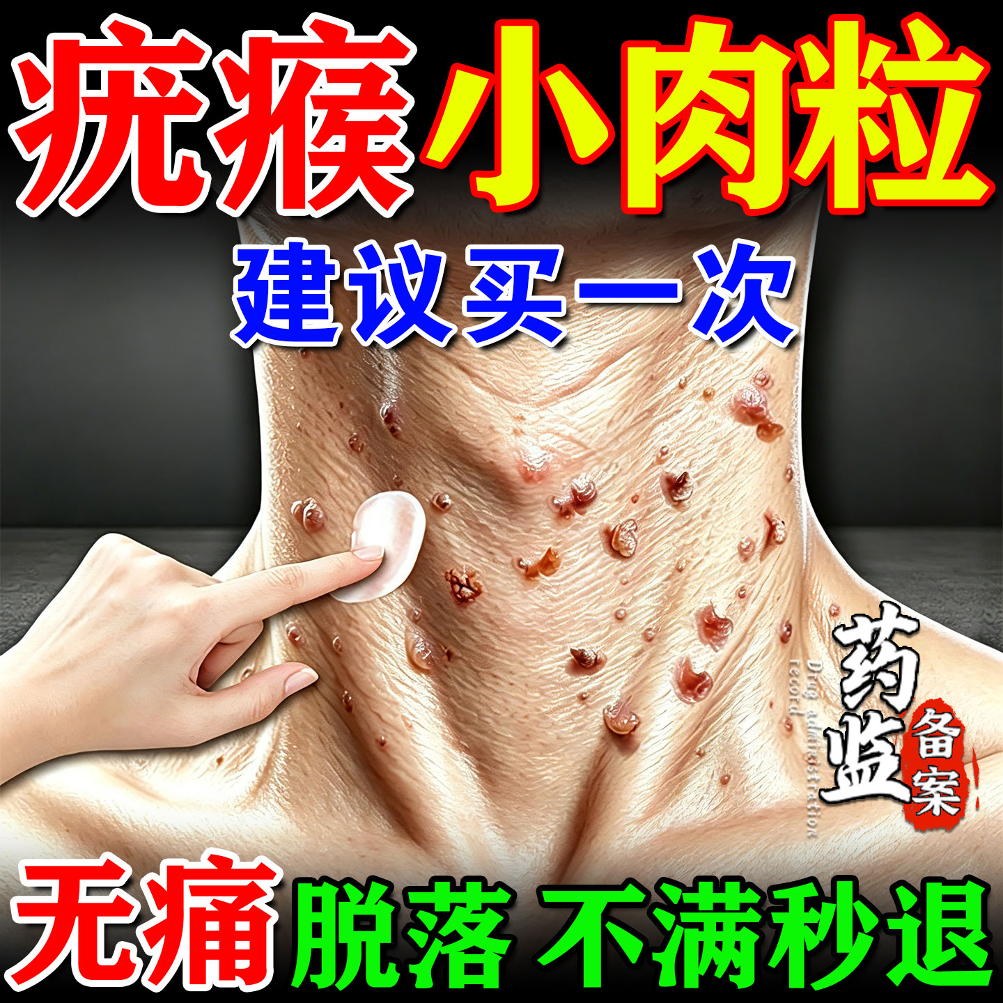 尤肤平疣瘊肉粒去除神器去疣膏斩草除根医用级祛疣瘊丝状疣扁平疣