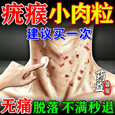 尤肤平疣瘊肉粒去除神器去疣膏斩草除根医用级祛疣瘊丝状疣扁平疣