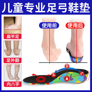 儿童内八字矫正鞋垫矫正器足弓垫适用于扁平足专用脚垫足外翻鞋