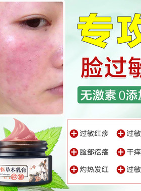过敏皮肤修覆脸部过敏止痒专用换季过敏怎么办面部化妆品红肿药膏
