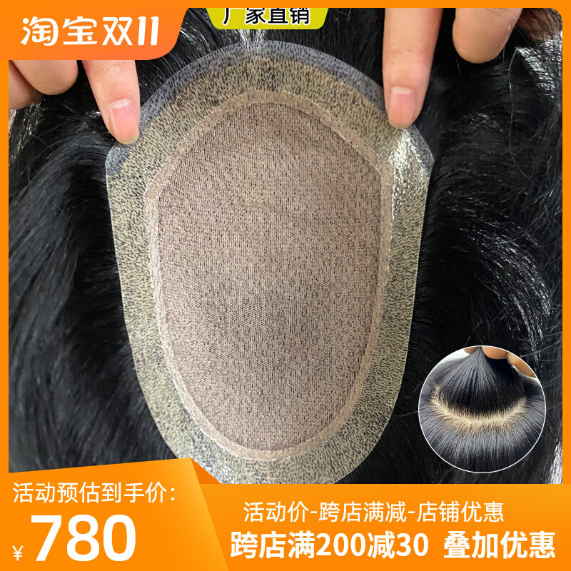递针男士假发块生物头皮高端隐形头顶真发补发片透气整顶补发片