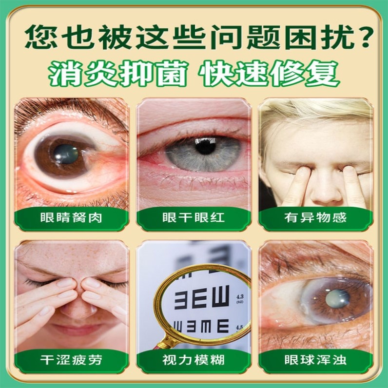 去除眼睛胬肉滴眼液眼睛长胬肉有异物感模糊看不清翼状胬肉眼药水