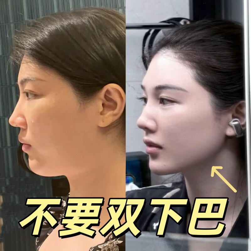 明星同款瘦脸神器提拉紧致消双下巴咬肌下颚线提拉脸部V脸绷带