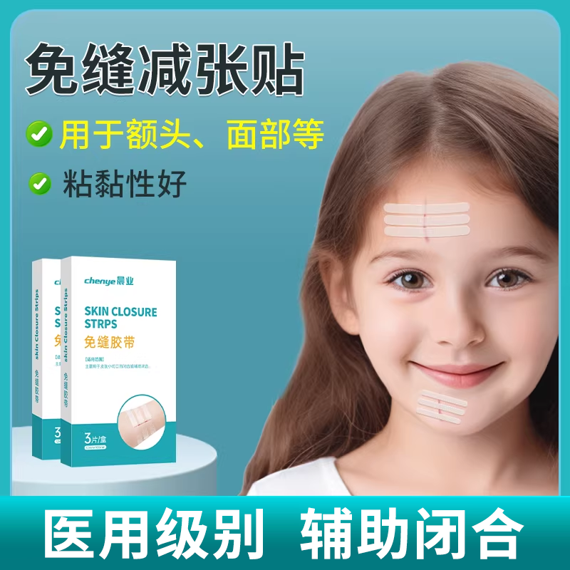 免缝胶带儿童减张贴疤痕贴医用术后伤口皮肤辅助闭合免缝合减张器