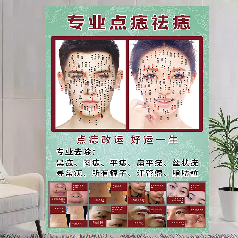 点痣图宣传海报痣相图面痣图祛痣广告去痣图图解取痣祛斑面部点斑