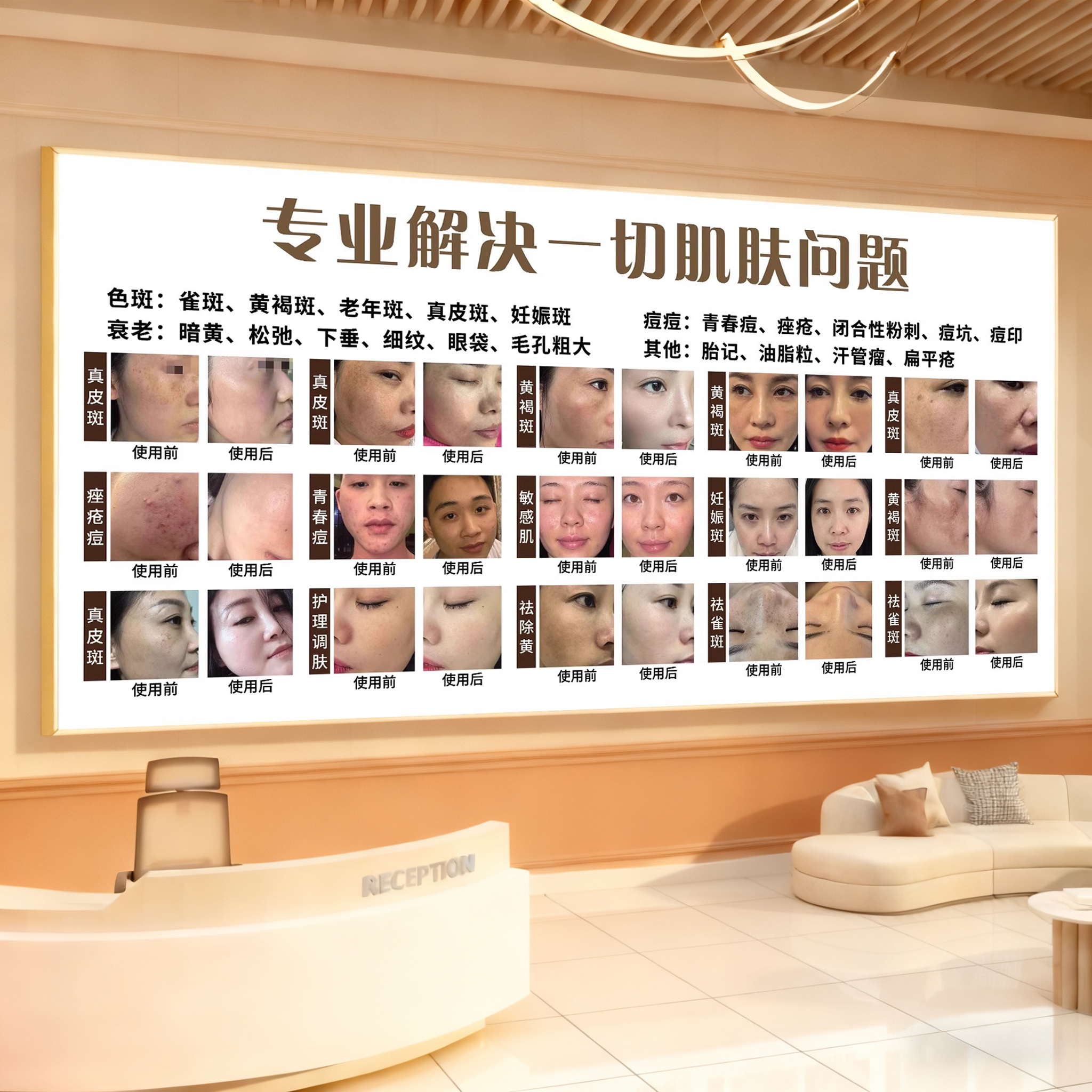 美容院墙面装饰挂画祛斑宣传海报