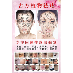 面部点痣图点痣宣传图痣相图取痣祛痣海报男女面痣祛斑点疣广告图