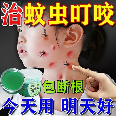 蚊虫叮咬快速止痒消肿驱蚊膏婴儿童宝宝专用药成人孕妇防蚊子神器