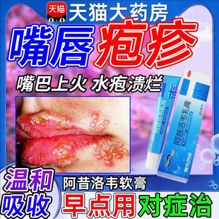 阿昔洛韦软膏带状疱疹唇炎水痘专用乳膏外用药膏正品官方旗舰店