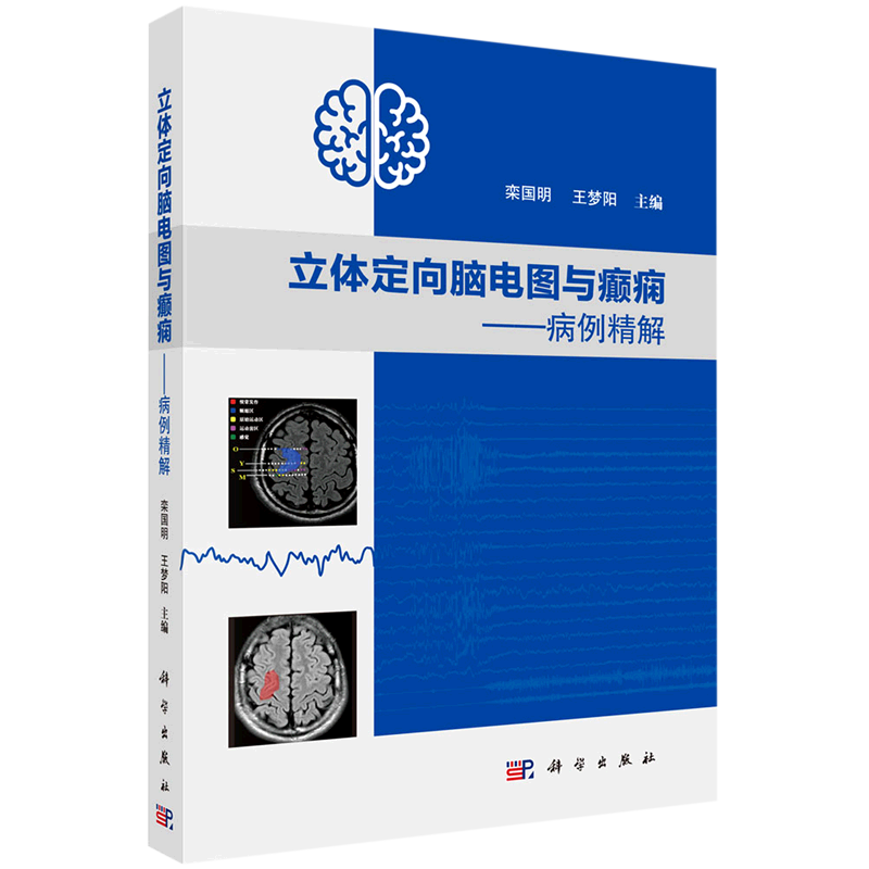 立体定向脑电图与癫痫:病例精解