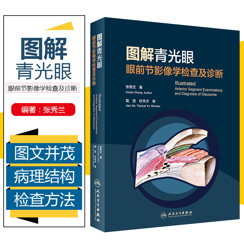 图解青光眼 眼前节影像学检查及诊断张秀兰眼科疾病临床案例诊治教程眼科学房角镜oct裂隙灯显微镜玻璃体角膜屈光视网膜病变工具书