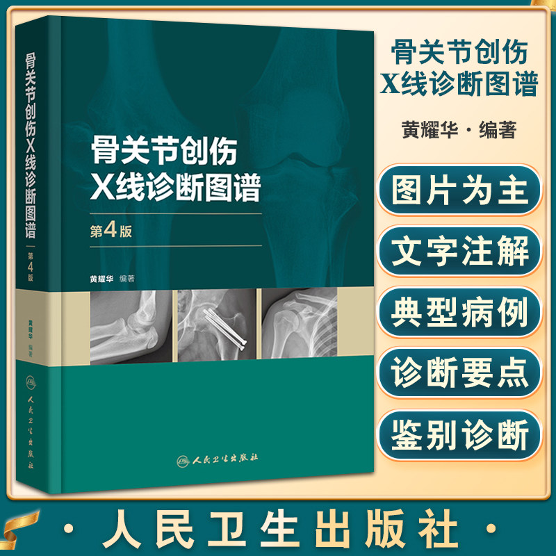 骨关节创伤X线诊断图谱(第4版) 骨科学外科学实用手术学检查临床典型常见病例肩部肘部骨折脱位髋部膝关节脚踝胸部脊柱
