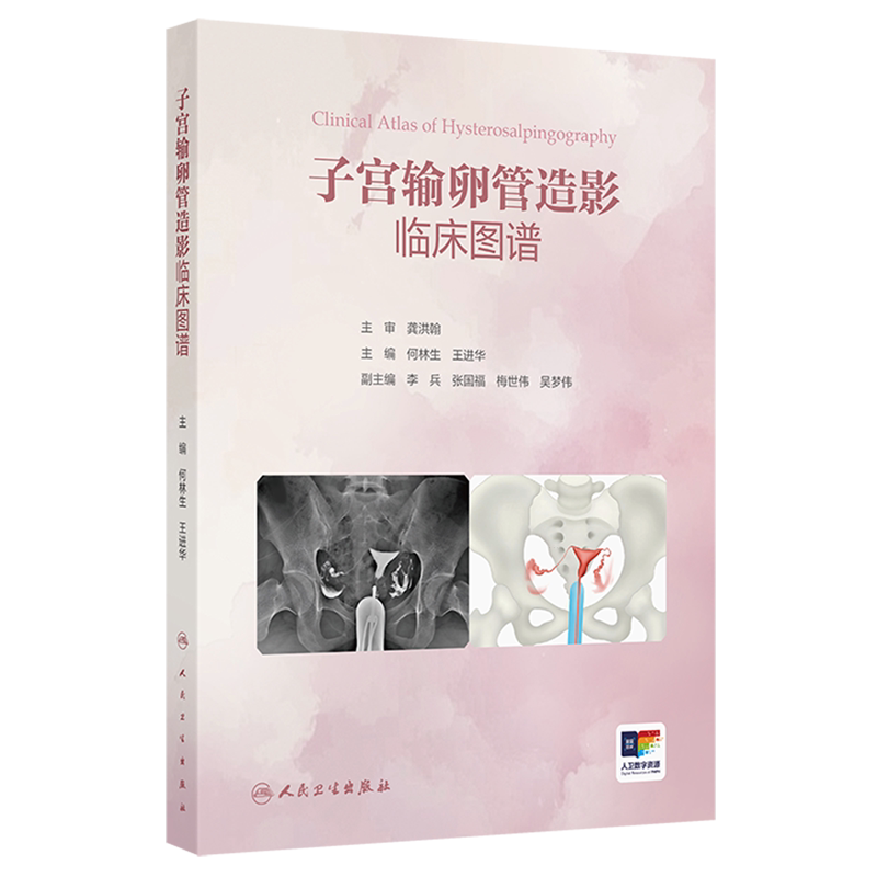 子宫输卵管造影临床图谱