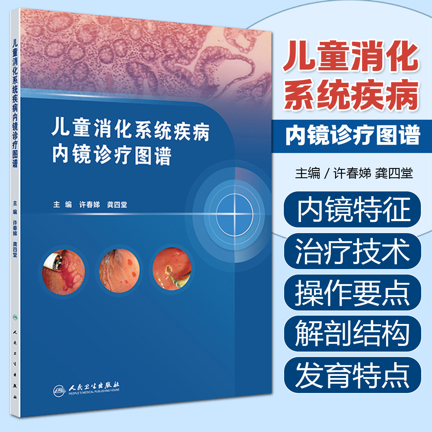 儿童消化系统疾病内镜诊疗图谱 许春娣 龚四堂 全面地阐述了儿科内镜在消化系统疾病中的应用和新进展 人民卫生出版社