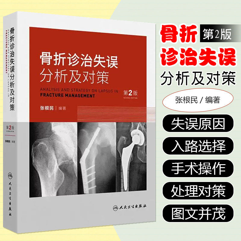 骨折诊治失误分析及对策 第2二版 张根民 病史采集中的失误 对骨折的严重并发症重视不够 石膏固定不当的分析及对策人民卫生出版社