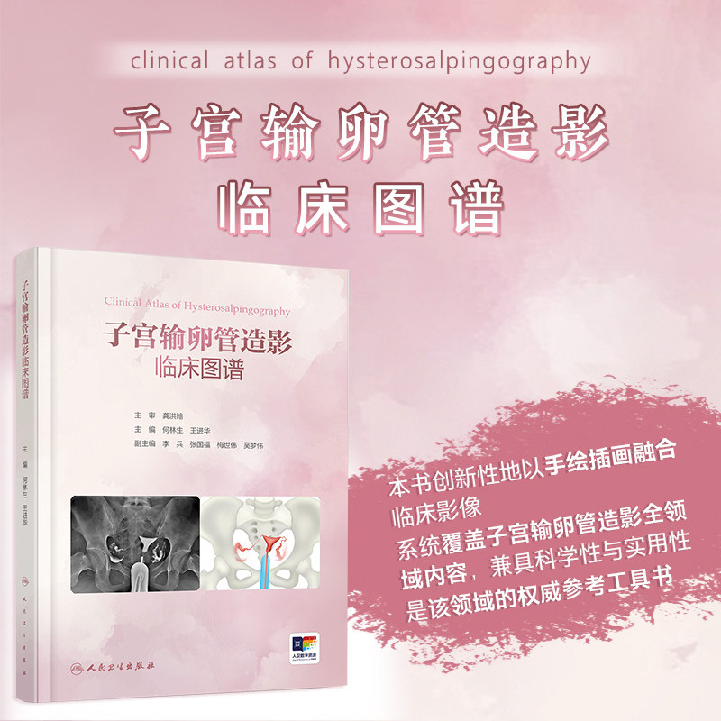 子宫输卵管造影临床图谱 何林生 王进华 主编 直观展示子宫输卵管造影的技术疾病诊断等 人民卫生出版社 9787117396257