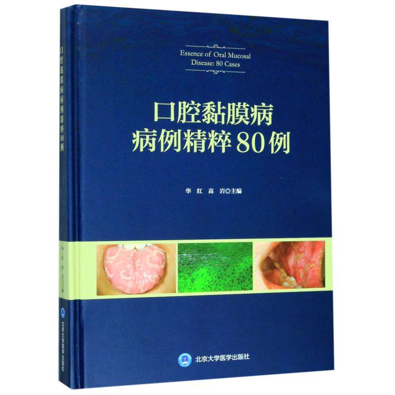 口腔黏膜病病例精粹80例(精)高性价比高么？