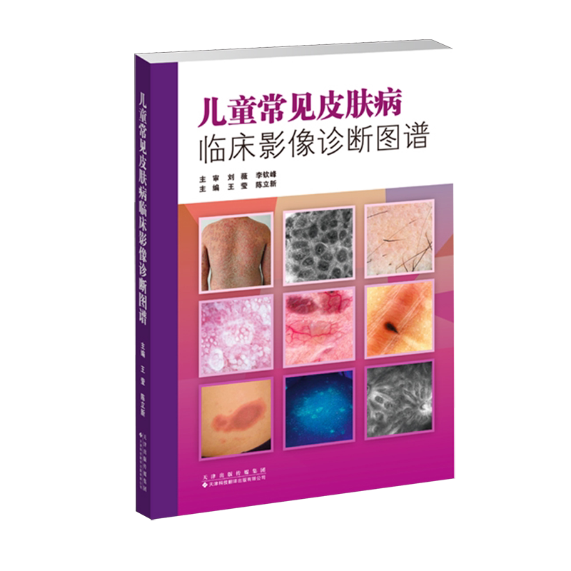 儿童常见皮肤病临床影像诊断图谱
