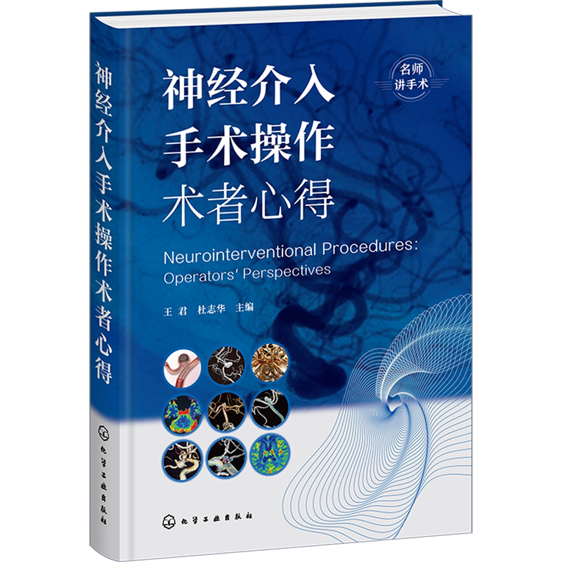 神经介入手术操作术者心得